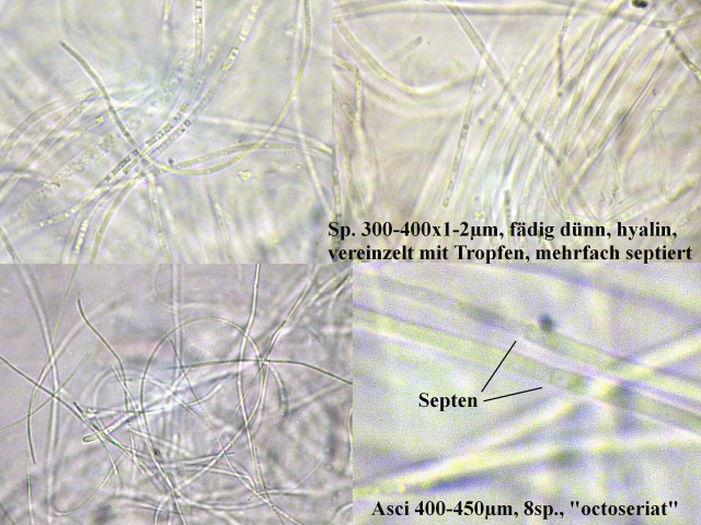Acrospermum_compressum_1a_Mikro